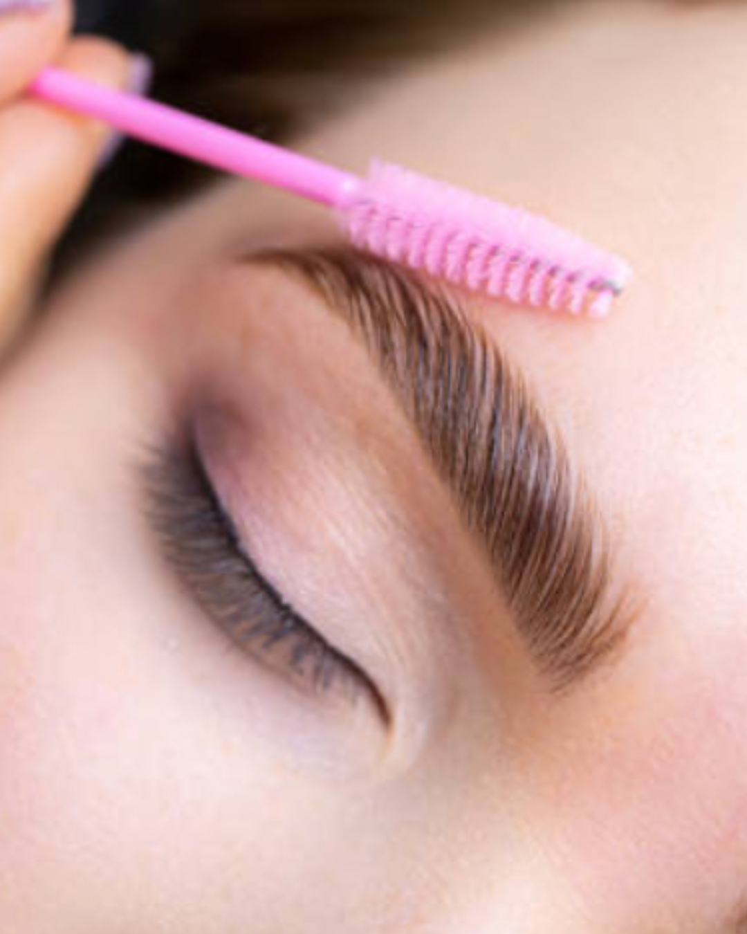 Brow lift